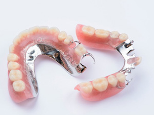 Two different partial dentures