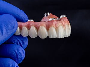 Blue-gloved hand holding upper arch of implant dentures with black background