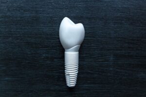 Dental implant on black background